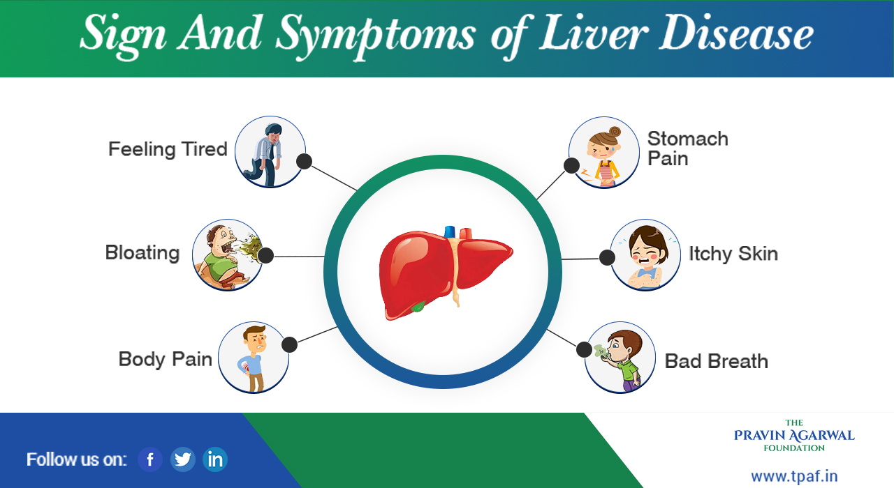 Top Symptoms of Liver Diseases You Should Be Aware Of